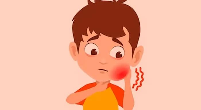 শিশুর মাম্পস হলে করবেন কী?