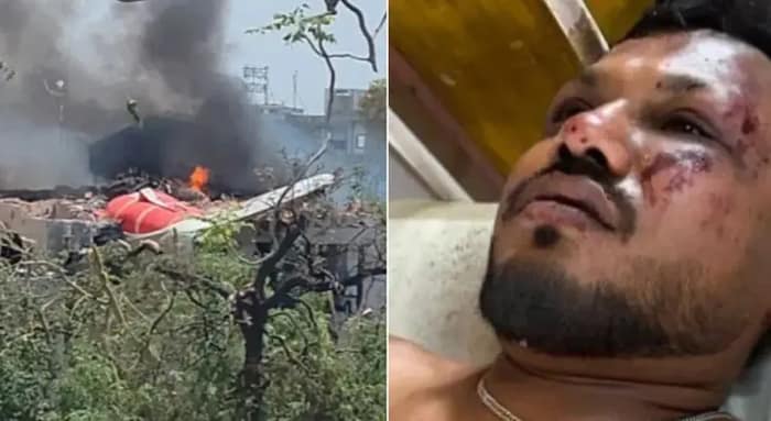 এখনও ট্রমায় আমেদাবাদ বিমান দুর্ঘটনায় একমাত্র জীবিত যাত্রী