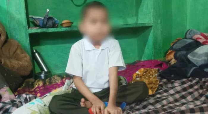 বিষাক্ত কফ সিরাপ কেড়ে নিয়েছে দৃষ্টিশক্তি  ১১৫ দিনের লড়াই জিতে বাড়ি ফিরল শিশু