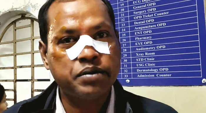 ব্যান্ডেলে ভিড় রাস্তায় সাইড দিতে না পারায় বেদম মার পশু চিকিৎসককে