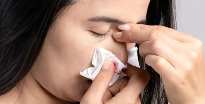 প্রবল গরমে নাক দিয়ে রক্ত পড়লে করবেন কী?