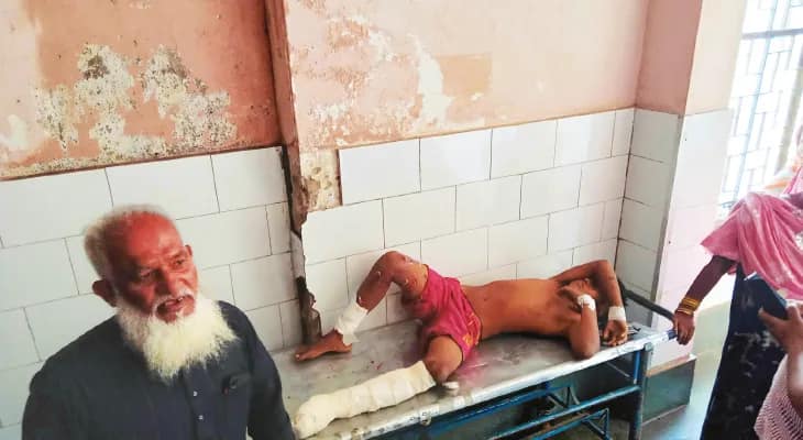 বহরমপুরে বোমা ফেটে পড়ুয়া সহ দু’জন জখম