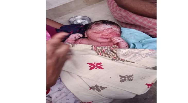বসিরহাটের আমবাগানে উদ্ধার কাপড়ে জড়ানো সদ্যোজাত শিশুকন্যা, চাঞ্চল্য