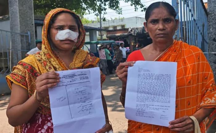 ঘুমন্ত স্ত্রীর নাক কামড়ে খুবলে নিল খোদ স্বামী