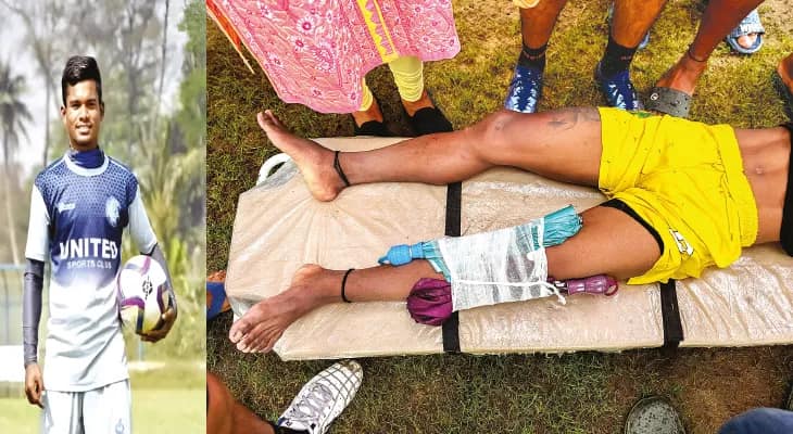 পায়ে ছাতা বেঁধে তারককে নিয়ে আসা হল হাসপাতালে