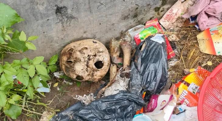 চুঁচুড়ায় ডাস্টবিন থেকে উদ্ধার খুলি ও হাড়, চাঞ্চল্য