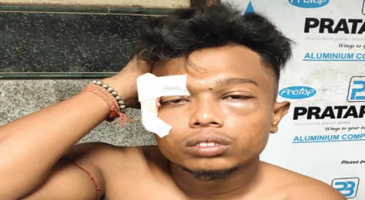 জোর করে চাঁদা আদায়ের প্রতিবাদ, কামারহাটির যুবককে বেধড়ক মার