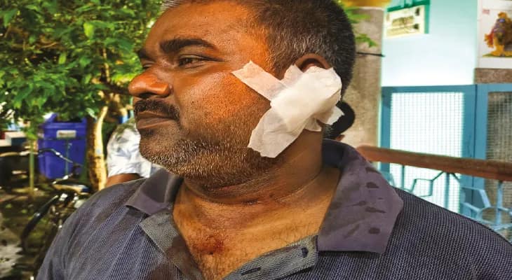 প্রাচীন মায়াপুরে কানে কামড় মদ্যপ যুবকের, শ্রবণেন্দ্রিয় খোয়ানোর জোগাড় প্রৌঢ়ের