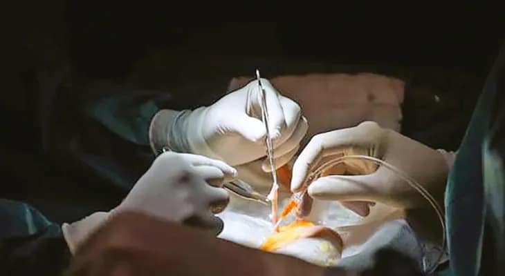আশ্চর্য আবিষ্কার: অঙ্গদান জীবনদান