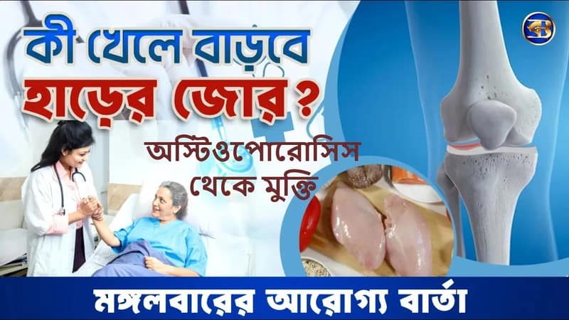 অস্টিওপোরোসিস 👉 কোন অভ্যাসে, কী খেলে ও কোন সহজ ব্যায়ামে হবে হাড় মজবুত? জানুন হাড়ের রহস্য!