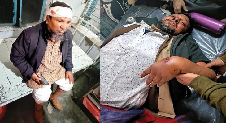 নতুন টিআইসির দু’হাত ভেঙে দেওয়ার অভিযোগ, জখম আরও এক শিক্ষক, প্রাক্তন টিআইসি, শাসকদলের নেতা সহ ১১ জনের নামে এফআইআর