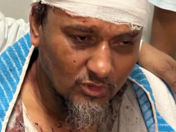 বারুইপুরে ব্যবসায়ীকে ভোজালির বাট দিয়ে মেরে লুটের অভিযোগ
