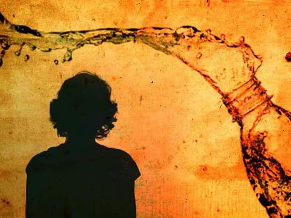 কুপ্রস্তাবে রাজি না হওয়ায় মহিলার উপর অ্যাসিড হামলা