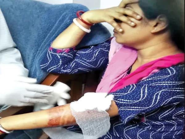 জগাছায় হনুমানের তাণ্ডব, আক্রান্ত ১৬